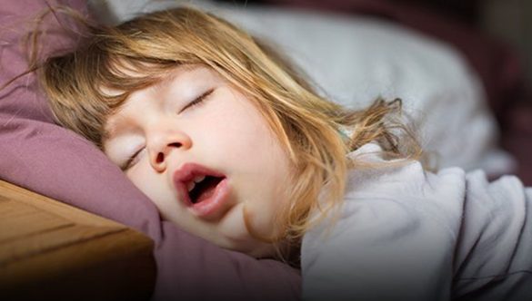 La respiración bucal puede alterar el desarrollo bucodental de los niños