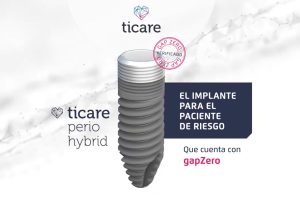 Nuevos implantes para pacientes periodontales. Una realidad