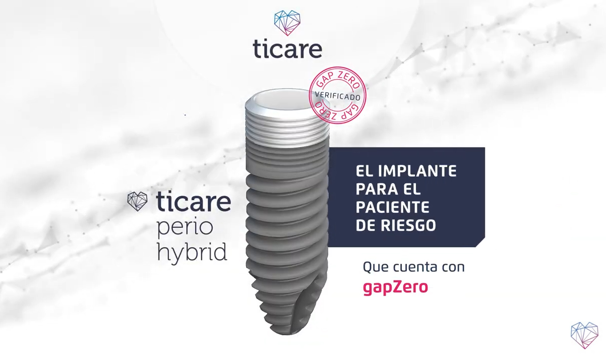 Nuevos implantes para pacientes periodontales. Una realidad